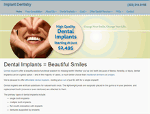 Tablet Screenshot of dentalimplantsdenverco.com